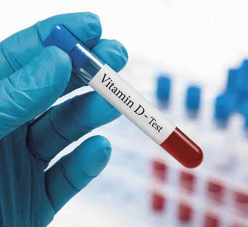 Vitamin D - test